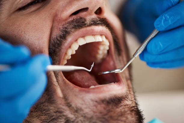 Best Emergency Dental Services for Seniors in Perry Park, CO